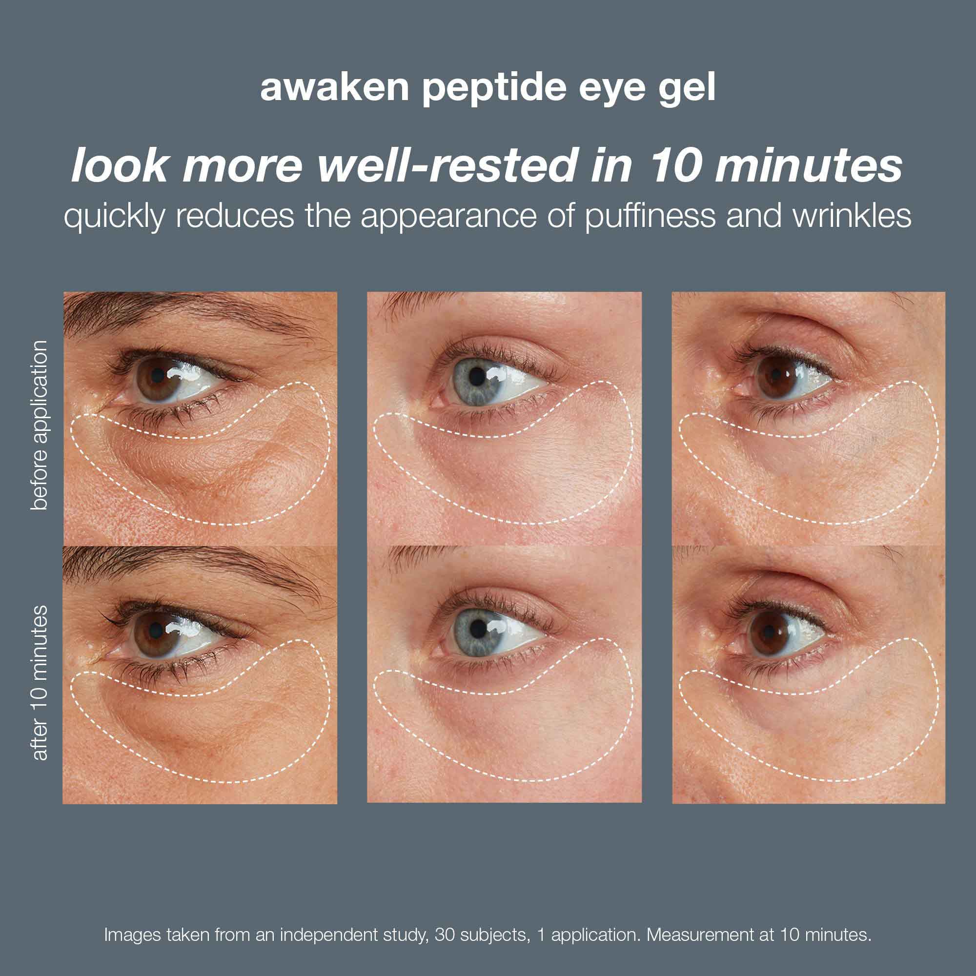 Awaken Peptide Depuffing Eye Gel - Image 8