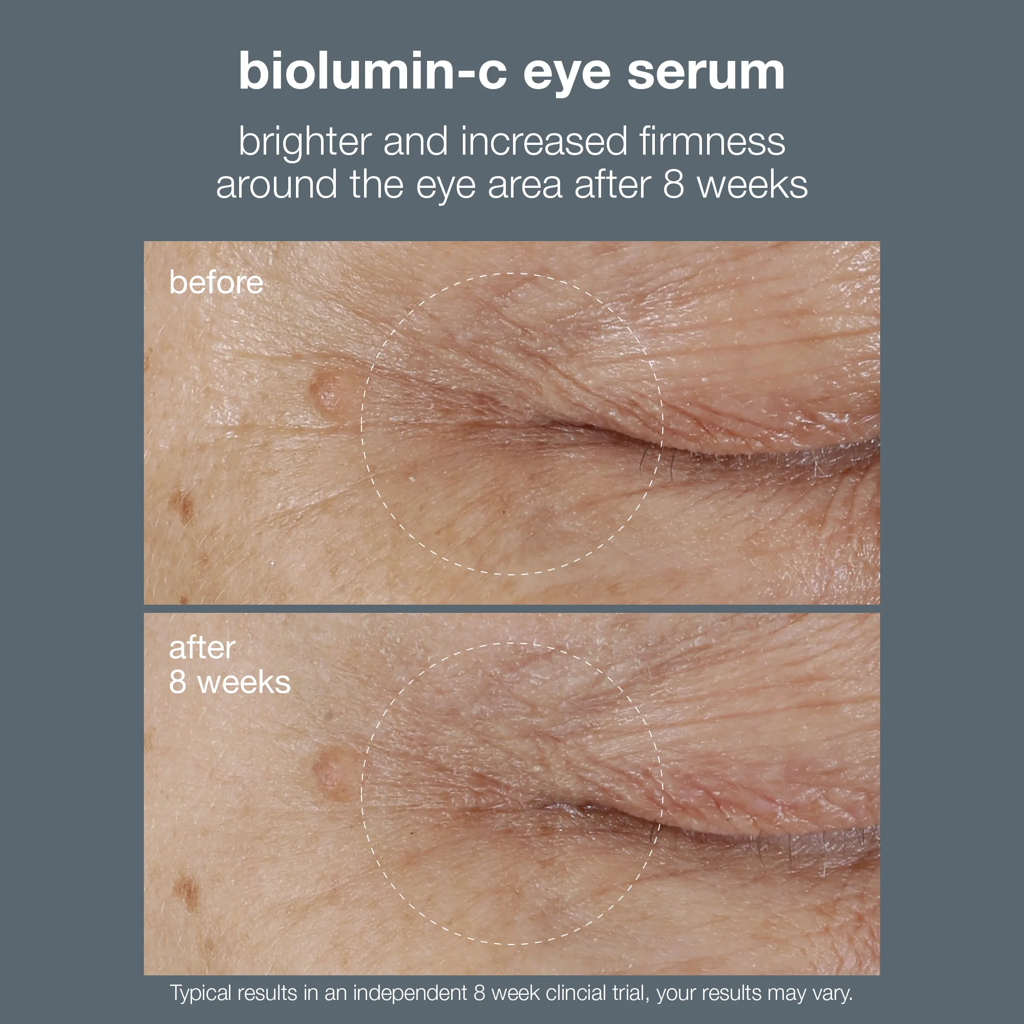 Biolumin-C Vitamin C Eye Serum - Image 7