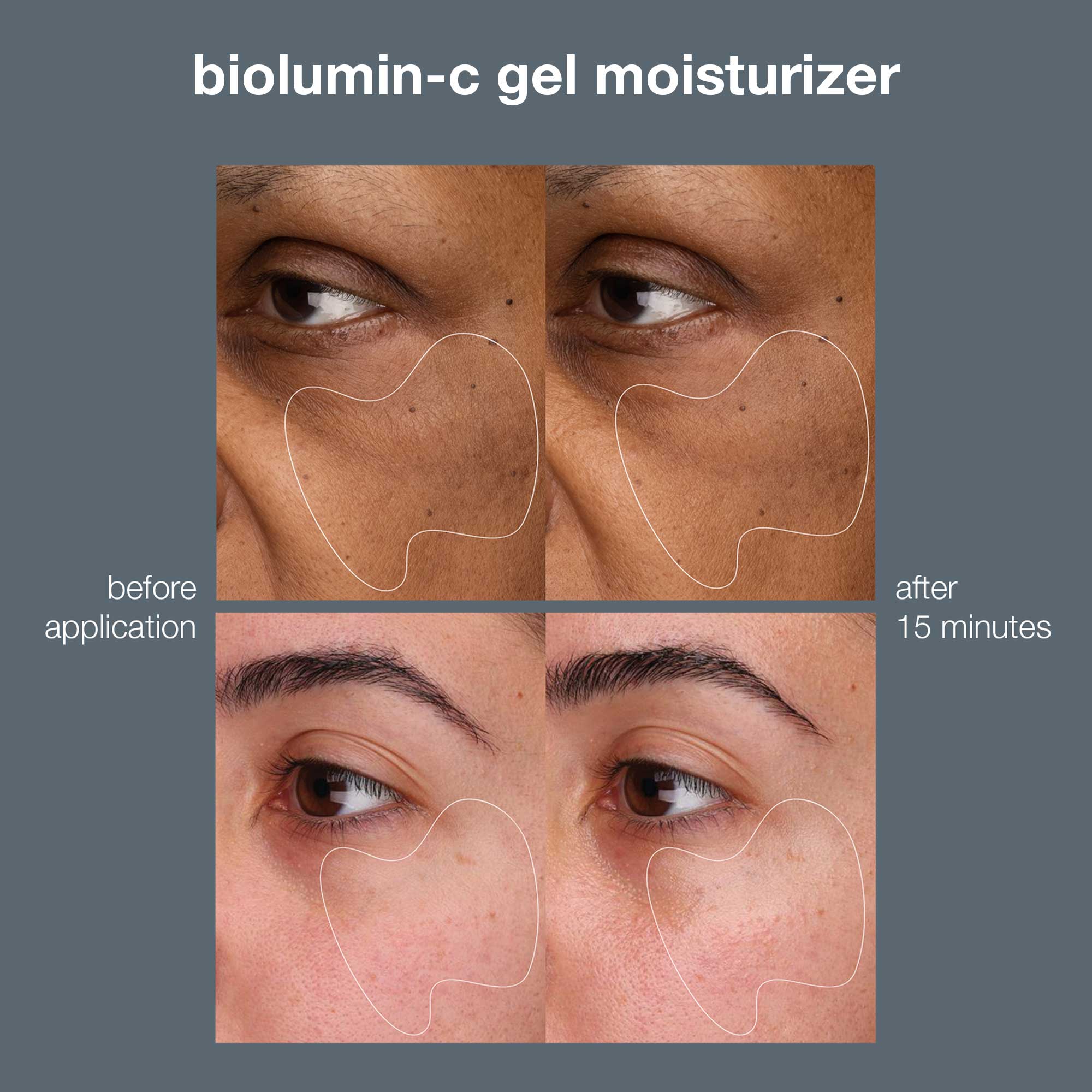 Biolumin-C Vitamin C Gel Moisturiser - Image 9