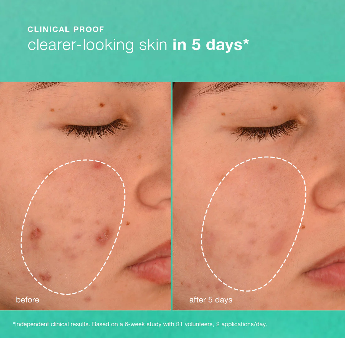 Breakout Biotic Moisturiser - Image 4