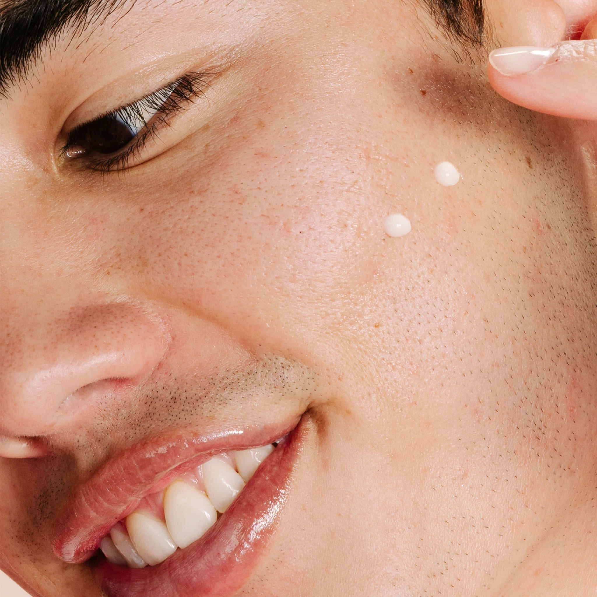 clear start breakout clearing kit - Image 6