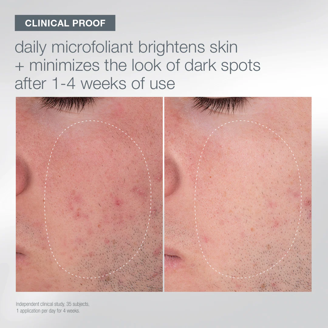 first snow of the season - Image 5