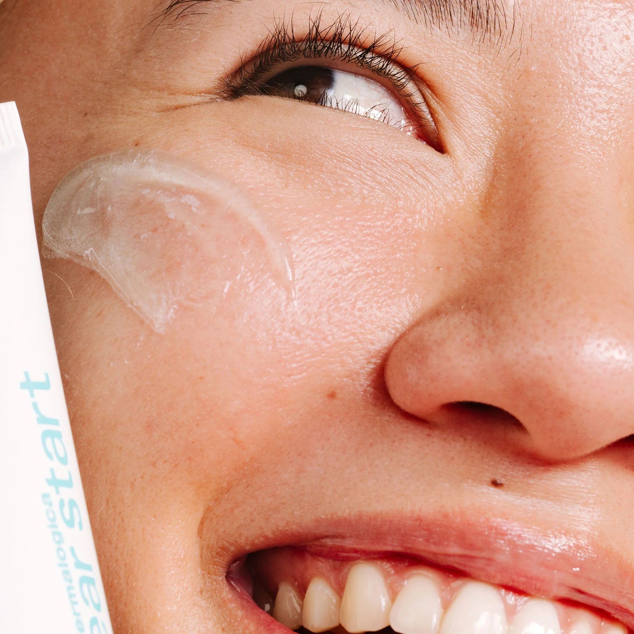 clear start breakout clearing kit - Image 7