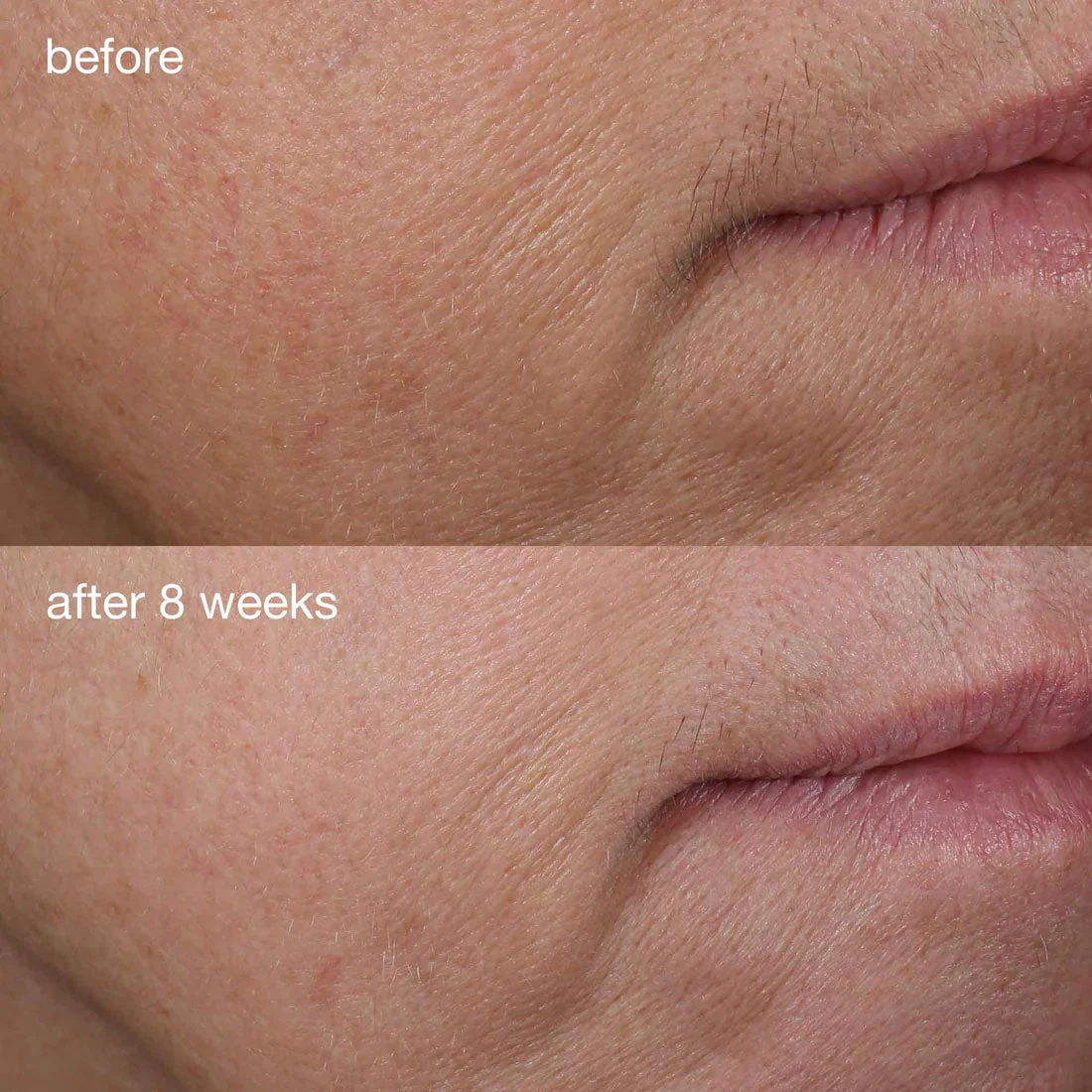 Phyto Nature Firming Serum - Image 7