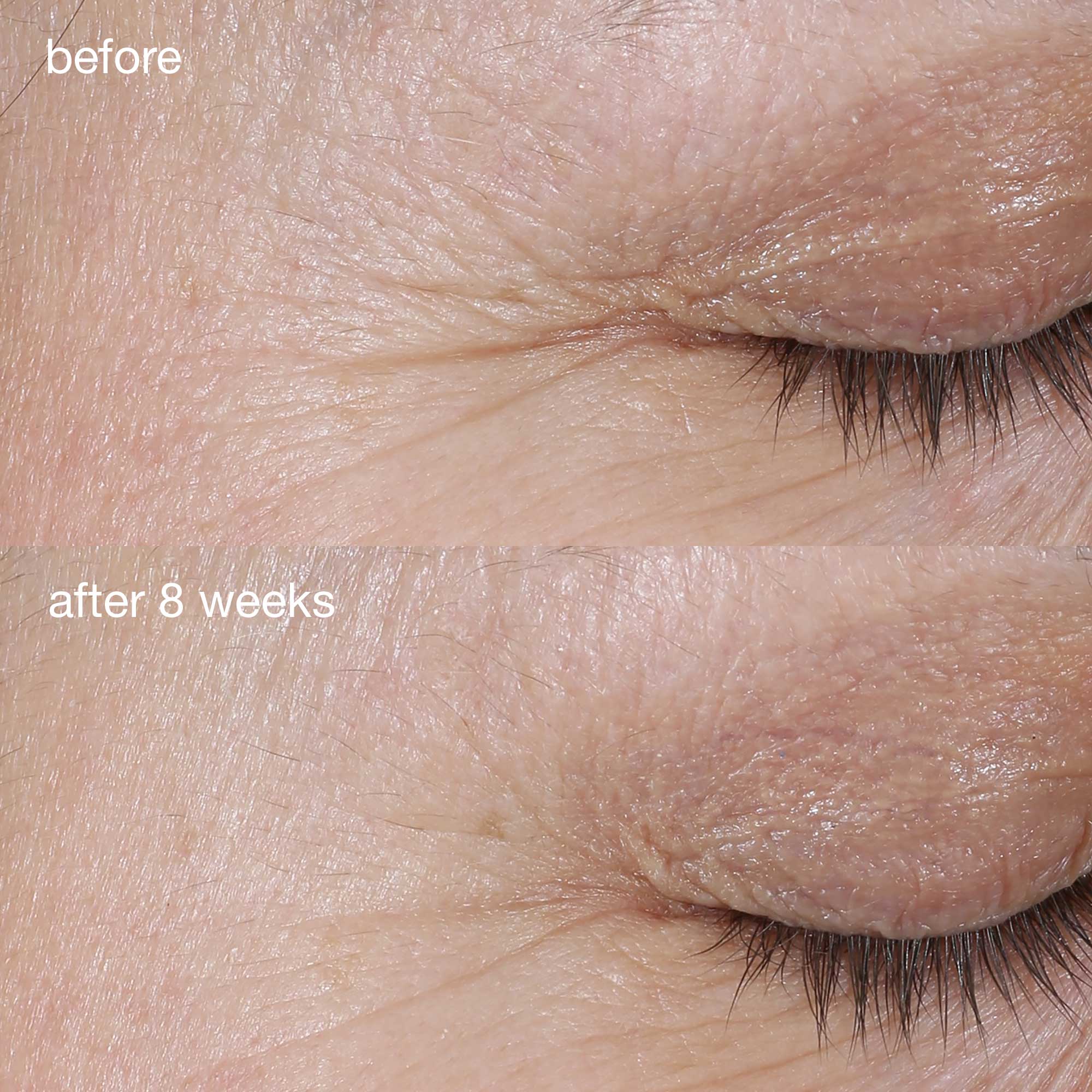 Phyto Nature Firming Serum - Image 8