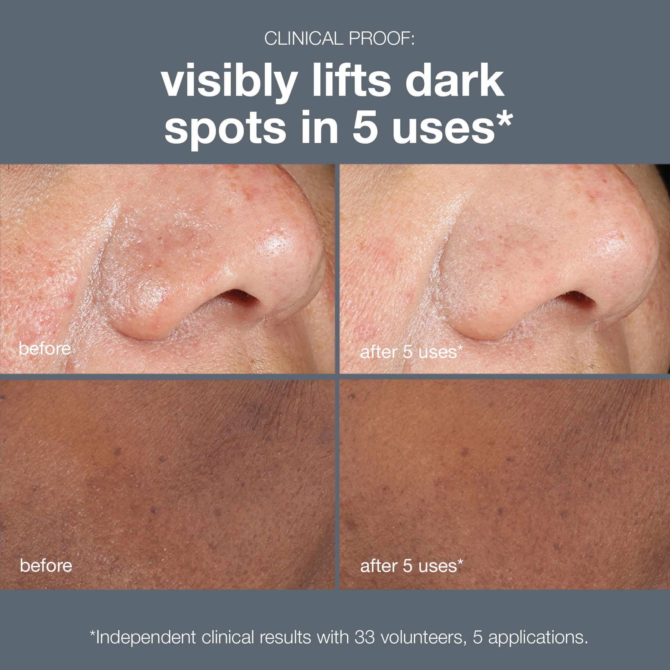 Powerbright Dark Spot Peel - Image 3
