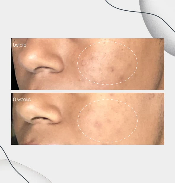 powerbright dark spot serum - Image 6