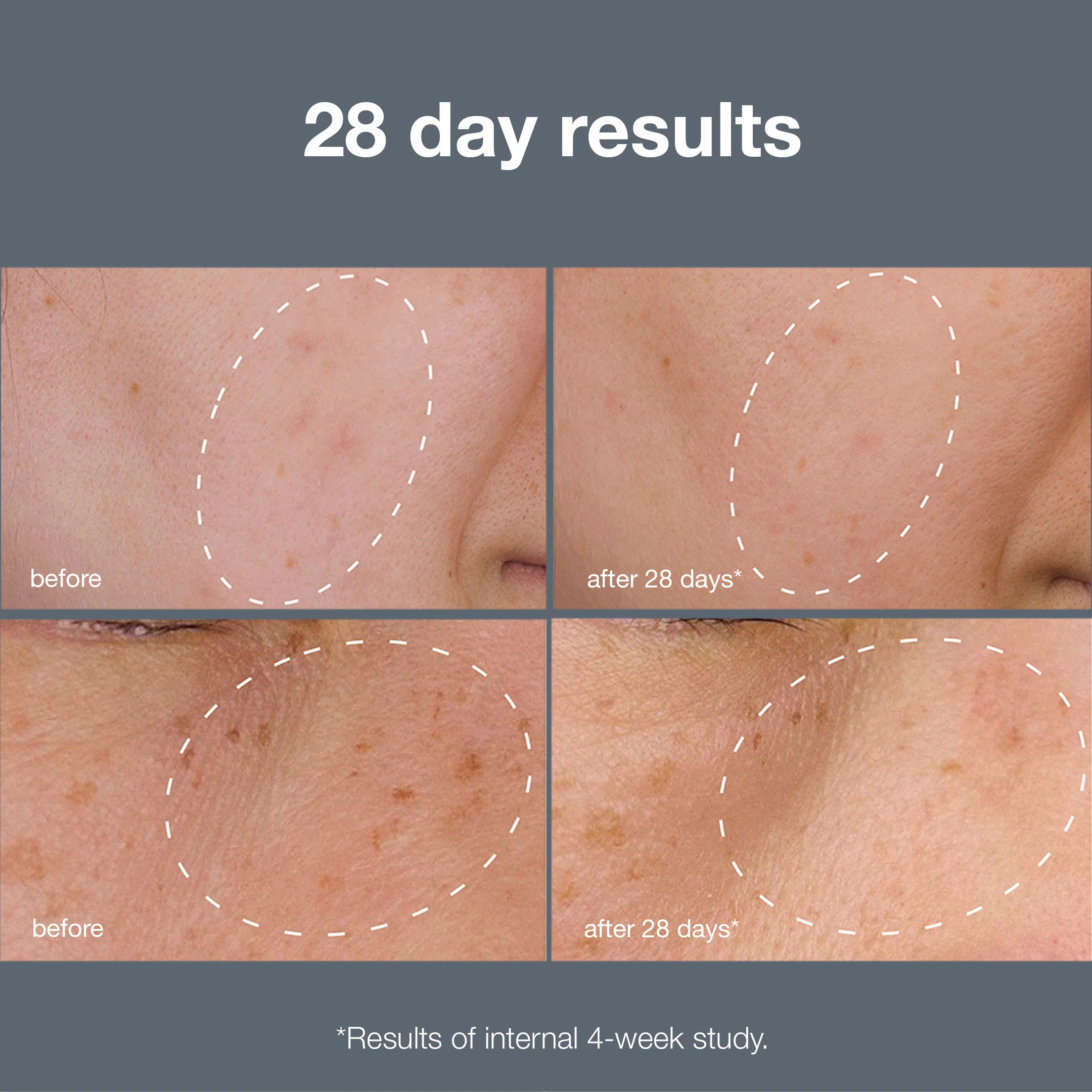 Powerbright Dark Spot System - Image 5