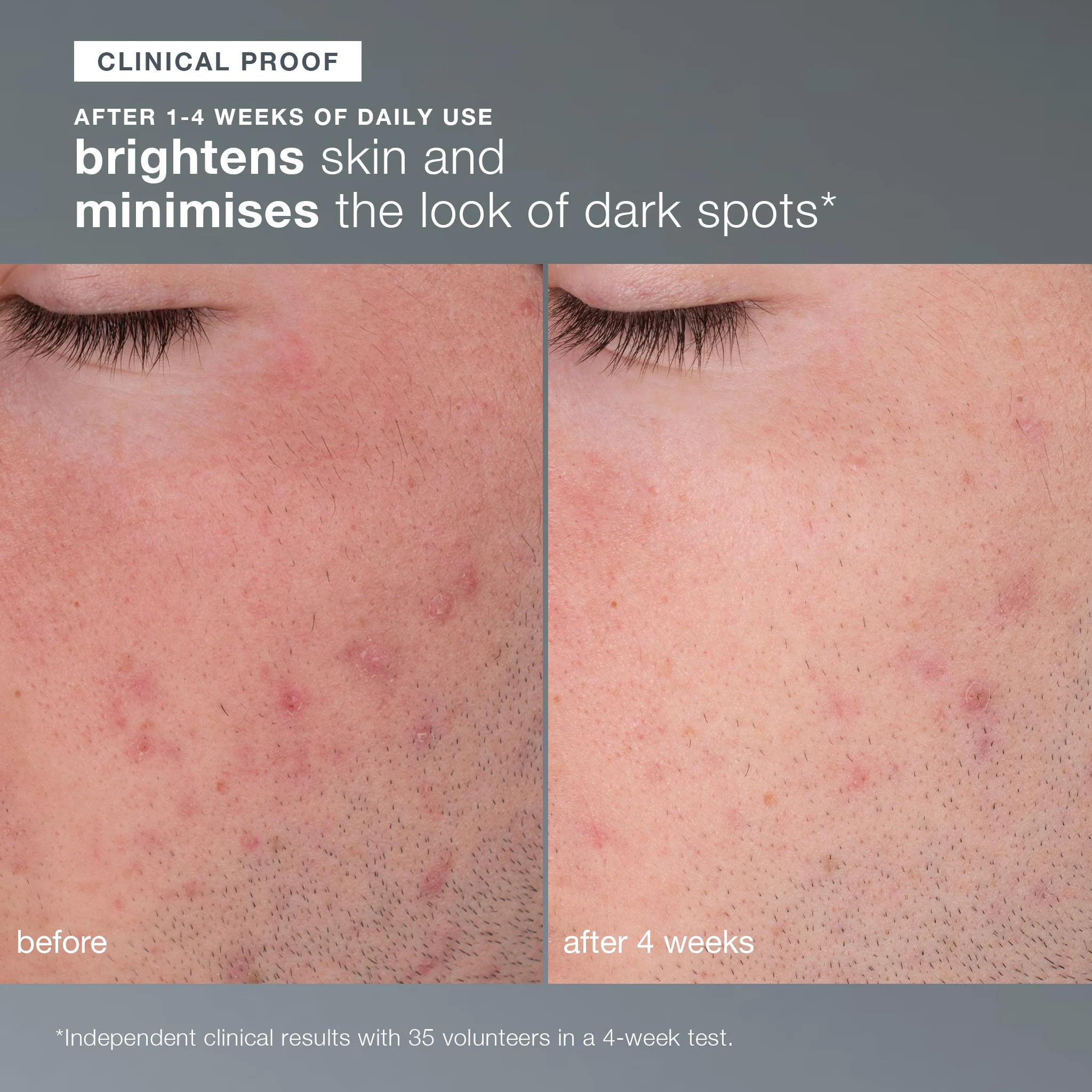 precleanse cleansing oil + daily microfoliant exfoliator - Image 3