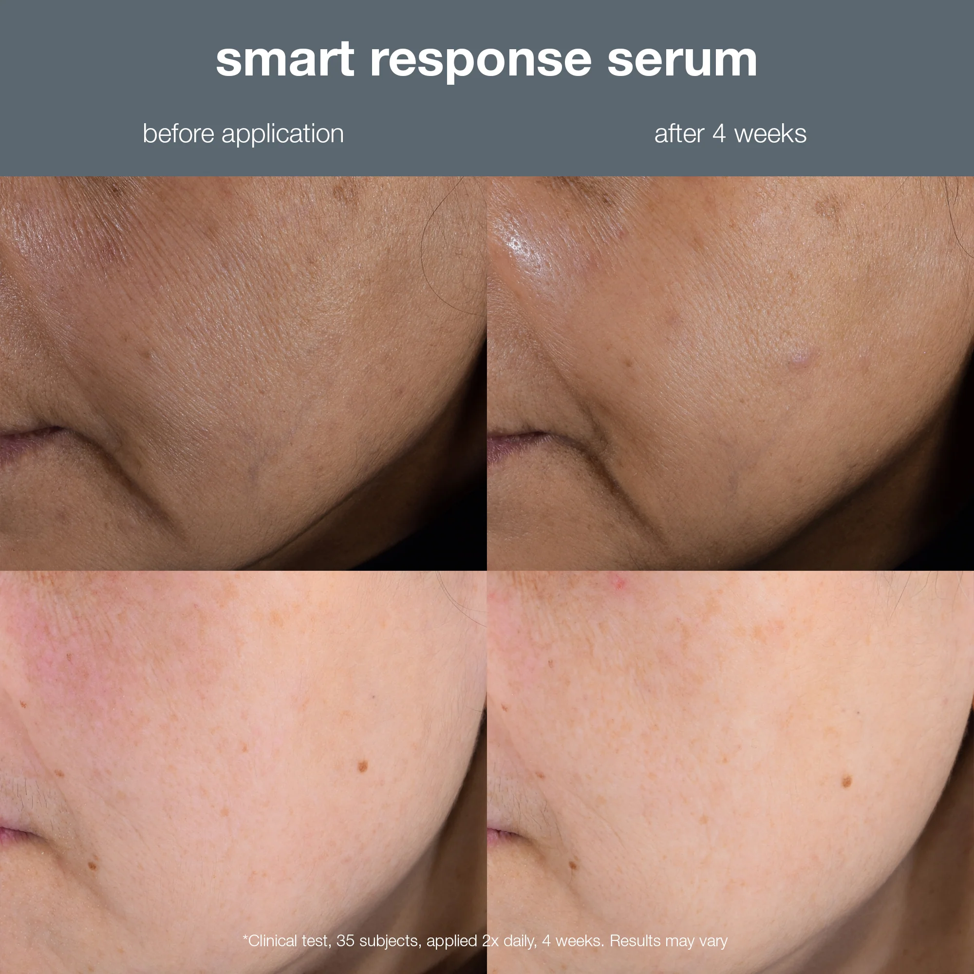 smart response serum - Image 7